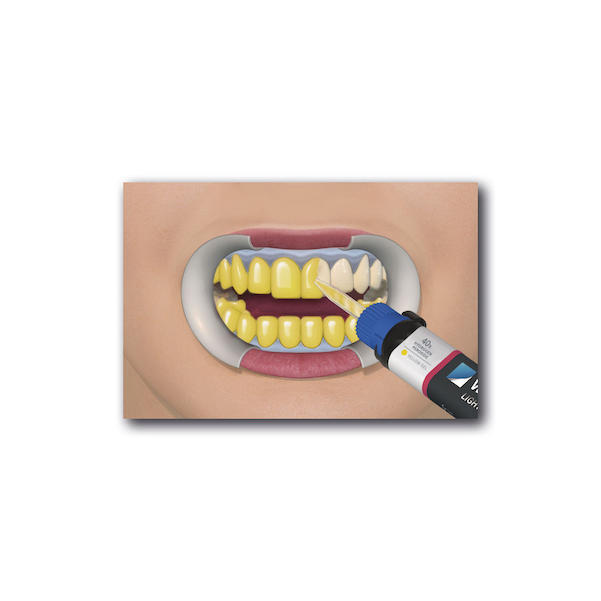Power Whitening YF