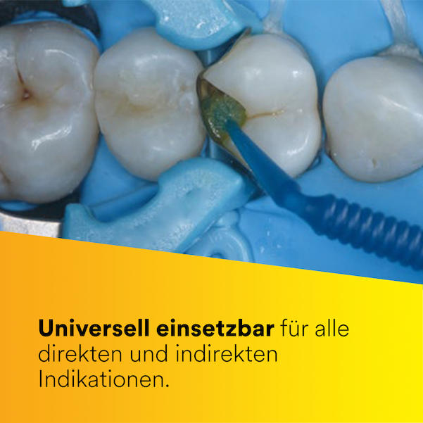 3M Scotchbond Universal Plus Adhäsiv, L-Pop - Nachfüllpackung