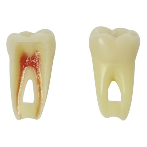 Endo-Modellzahn mit Schraube