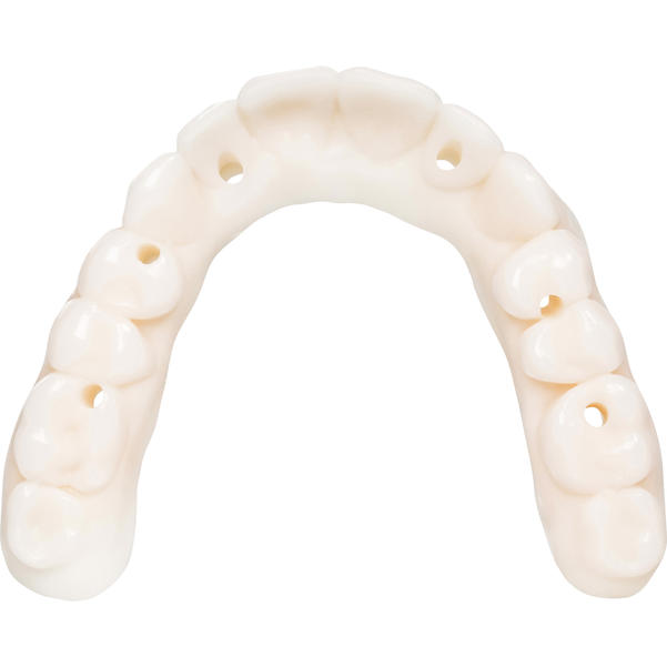 KeyDenture Try In™